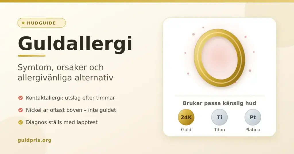 Grafik med rubriken "Guldallergi – symtom, orsaker och allergivänliga alternativ", där en guldring omges av rodnad hud och hudvänliga metaller som 24 karat guld, titan och platina visas.