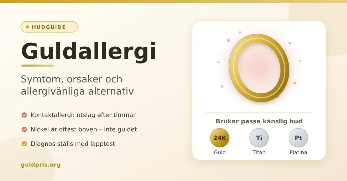 Grafik med rubriken "Guldallergi – symtom, orsaker och allergivänliga alternativ", där en guldring omges av rodnad hud och hudvänliga metaller som 24 karat guld, titan och platina visas.